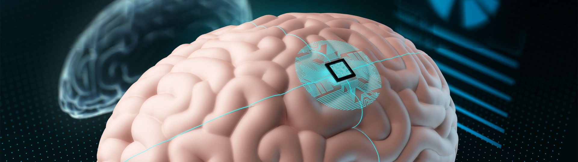 Neuralink vyvíjející mozkové čipy může zahájit testování na lidech